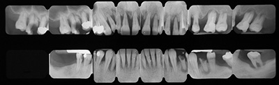 status-radiografico